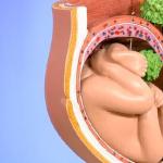 Efekti i ureaplasmosis në shtatzëni: rreziku i ureaplasma për gratë dhe fëmijët, trajtimi dhe parandalimi Çfarë është ureaplasma në gratë shtatzëna