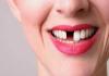 Denti che cadono in sogno con sangue: cosa significa?