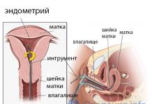 Biopsia endometriale e tubave: çfarë është, si kryhet