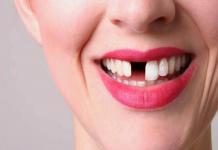 Denti che cadono in sogno con sangue: cosa significa?