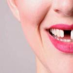 Zuby vypadávajúce vo sne s krvou: čo to znamená?